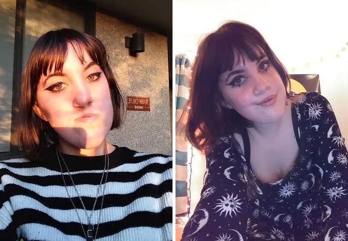 30 “Ugly Ducklings” Share Their Incredible Transformations Into Beautiful Swans (New Pics) 30 “Ugly Ducklings” Share Their Incredible Transformations Into Beautiful Swans (New Pics)