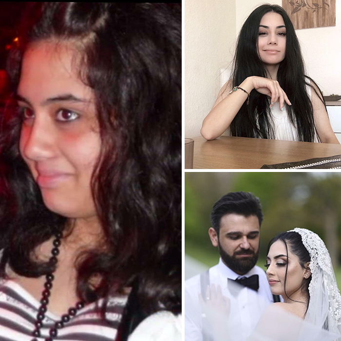 30 “Ugly Ducklings” Share Their Incredible Transformations Into Beautiful Swans (New Pics) 30 “Ugly Ducklings” Share Their Incredible Transformations Into Beautiful Swans (New Pics)