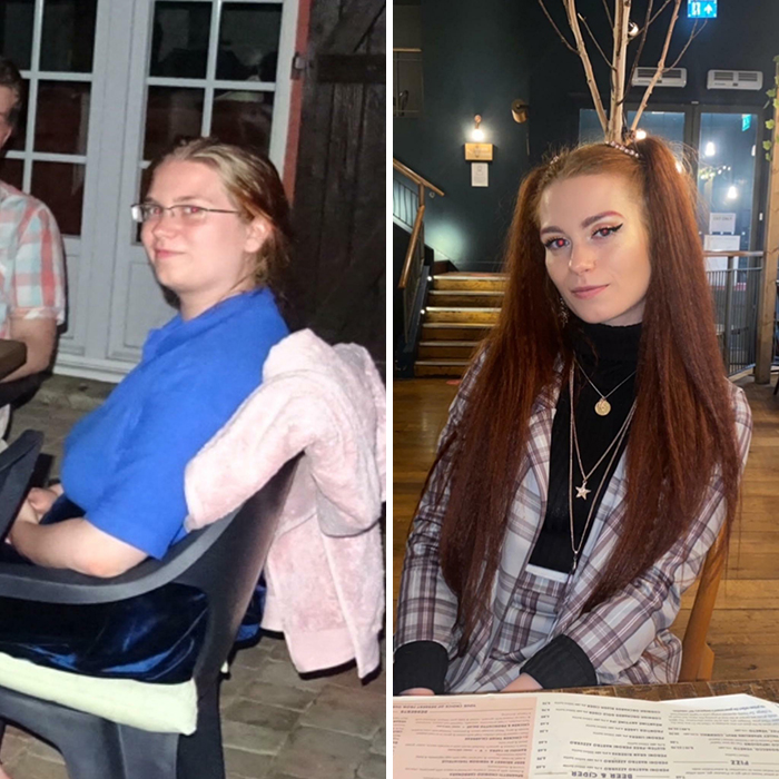 30 “Ugly Ducklings” Share Their Incredible Transformations Into Beautiful Swans (New Pics) 30 “Ugly Ducklings” Share Their Incredible Transformations Into Beautiful Swans (New Pics)