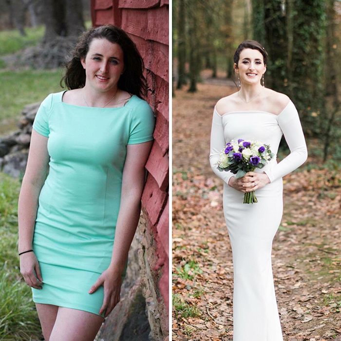 30 “Ugly Ducklings” Share Their Incredible Transformations Into Beautiful Swans (New Pics) 30 “Ugly Ducklings” Share Their Incredible Transformations Into Beautiful Swans (New Pics)