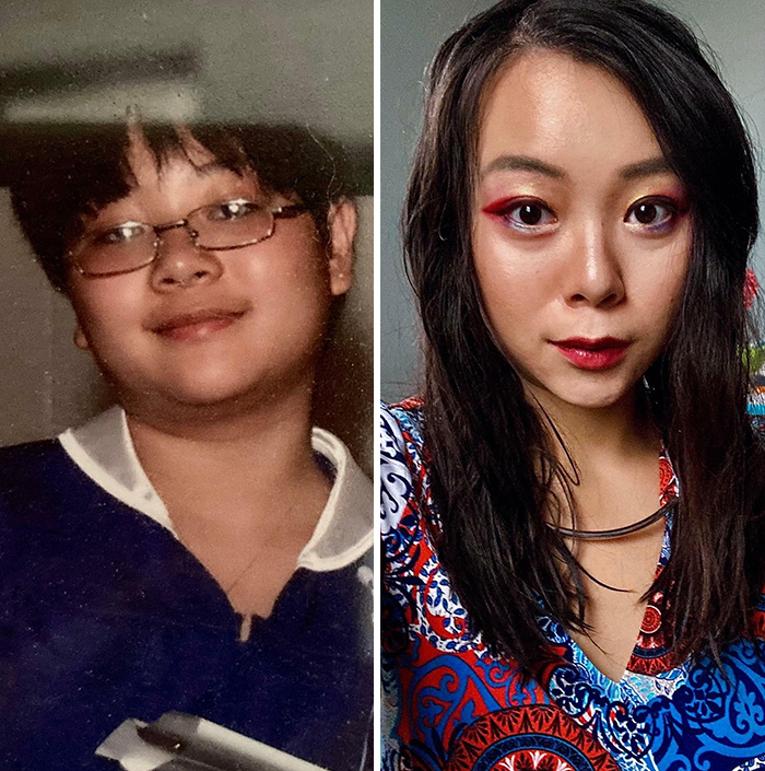 30 “Ugly Ducklings” Share Their Incredible Transformations Into Beautiful Swans (New Pics) 30 “Ugly Ducklings” Share Their Incredible Transformations Into Beautiful Swans (New Pics)