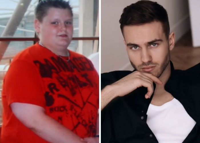 “How Hard Did Puberty Hit You”: 30 People Who Took Part In This New TikTok Challenge And Shared Photos “How Hard Did Puberty Hit You”: 30 People Who Took Part In This New TikTok Challenge And Shared Photos