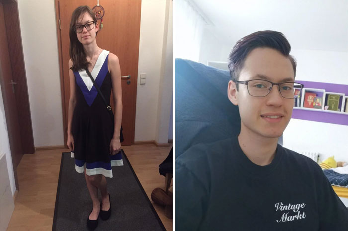 30 Wholesome Posts By “Ugly Ducklings” About The Incredible Transformations They Undertook (New Pics) 30 Wholesome Posts By “Ugly Ducklings” About The Incredible Transformations They Undertook (New Pics)