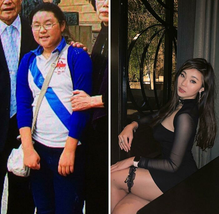 30 Wholesome Posts By “Ugly Ducklings” About The Incredible Transformations They Undertook (New Pics) 30 Wholesome Posts By “Ugly Ducklings” About The Incredible Transformations They Undertook (New Pics)