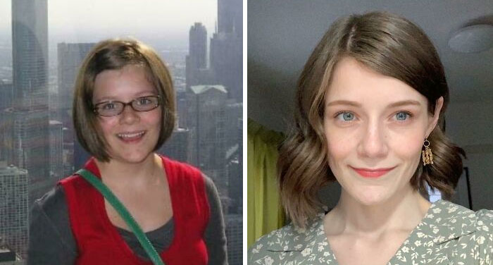 30 Wholesome Posts By “Ugly Ducklings” About The Incredible Transformations They Undertook (New Pics) 30 Wholesome Posts By “Ugly Ducklings” About The Incredible Transformations They Undertook (New Pics)