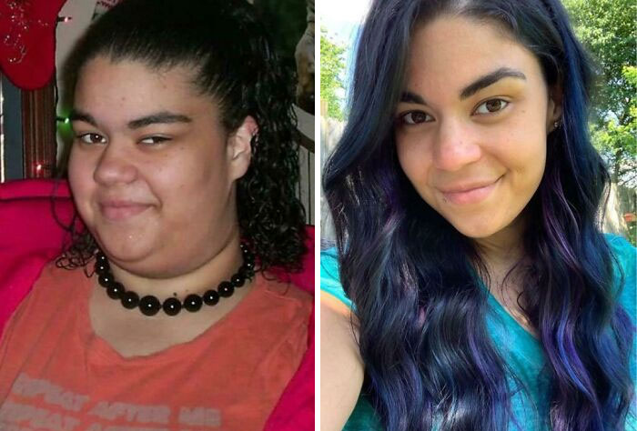 30 Wholesome Posts By “Ugly Ducklings” About The Incredible Transformations They Undertook (New Pics) 30 Wholesome Posts By “Ugly Ducklings” About The Incredible Transformations They Undertook (New Pics)