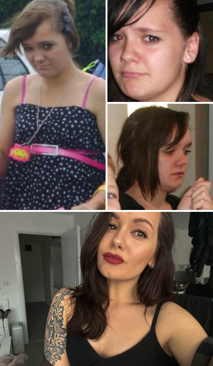 30 Wholesome Posts By “Ugly Ducklings” About The Incredible Transformations They Undertook (New Pics) 30 Wholesome Posts By “Ugly Ducklings” About The Incredible Transformations They Undertook (New Pics)