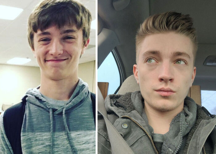 30 Wholesome Posts By “Ugly Ducklings” About The Incredible Transformations They Undertook (New Pics) 30 Wholesome Posts By “Ugly Ducklings” About The Incredible Transformations They Undertook (New Pics)