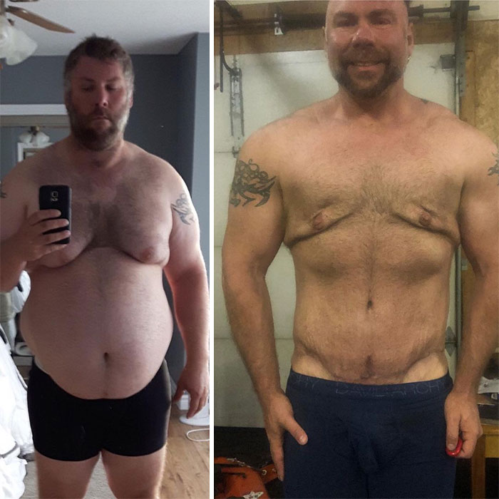 Guy Loses Half Of His Body Weight After Surviving A Near-Fatal Heart Attack And Looks Unrecognizable Guy Loses Half Of His Body Weight After Surviving A Near-Fatal Heart Attack And Looks Unrecognizable
