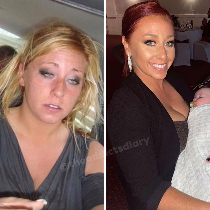 ‘The Addict’s Diary’ Showcases Before & After Transformations Of People Who Quit Drugs (30 Stories) ‘The Addict’s Diary’ Showcases Before & After Transformations Of People Who Quit Drugs (30 Stories)