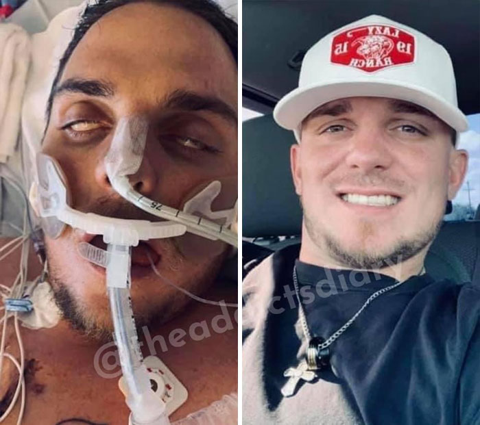 ‘The Addict’s Diary’ Showcases Before & After Transformations Of People Who Quit Drugs (30 Stories) ‘The Addict’s Diary’ Showcases Before & After Transformations Of People Who Quit Drugs (30 Stories)