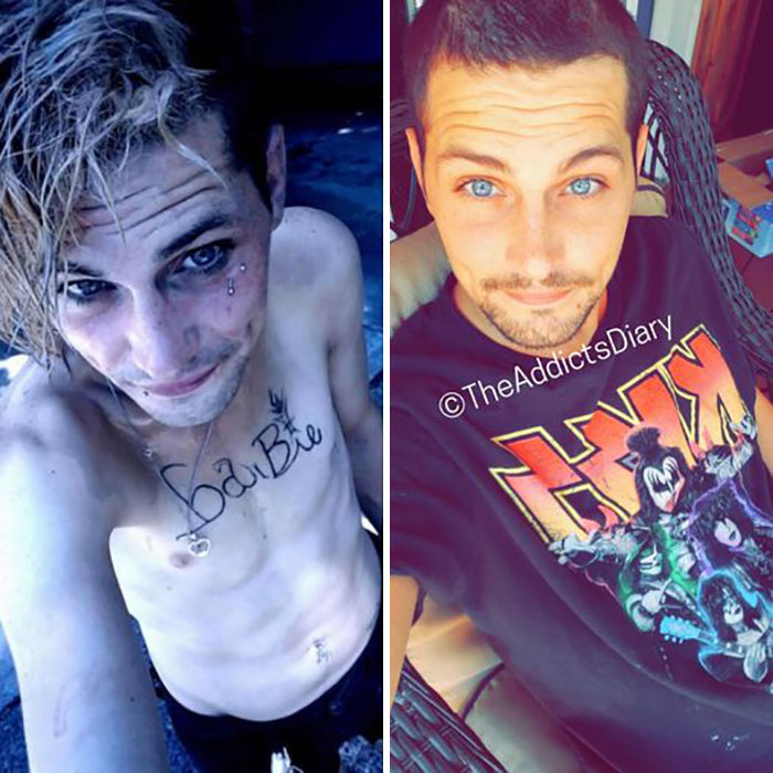 ‘The Addict’s Diary’ Showcases Before & After Transformations Of People Who Quit Drugs (30 Stories) ‘The Addict’s Diary’ Showcases Before & After Transformations Of People Who Quit Drugs (30 Stories)