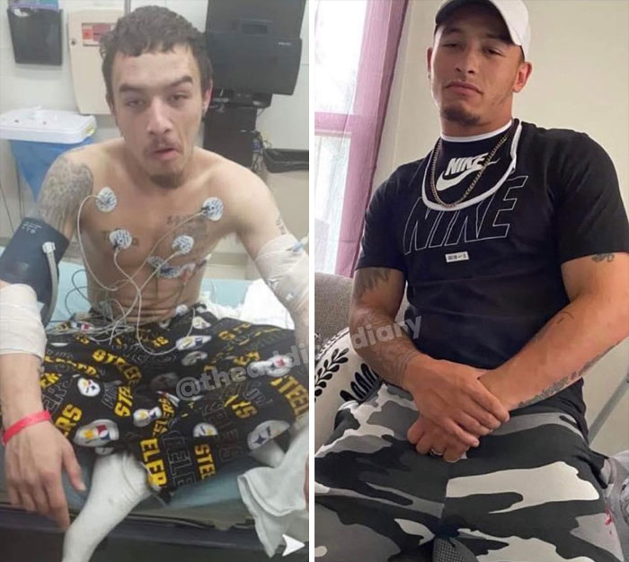 ‘The Addict’s Diary’ Showcases Before & After Transformations Of People Who Quit Drugs (30 Stories) ‘The Addict’s Diary’ Showcases Before & After Transformations Of People Who Quit Drugs (30 Stories)