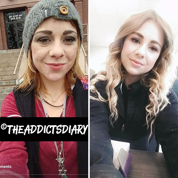 ‘The Addict’s Diary’ Showcases Before & After Transformations Of People Who Quit Drugs (30 Stories) ‘The Addict’s Diary’ Showcases Before & After Transformations Of People Who Quit Drugs (30 Stories)