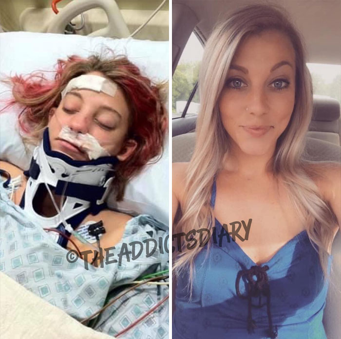 ‘The Addict’s Diary’ Showcases Before & After Transformations Of People Who Quit Drugs (30 Stories) ‘The Addict’s Diary’ Showcases Before & After Transformations Of People Who Quit Drugs (30 Stories)