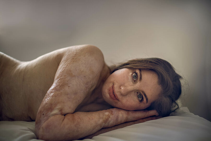 My 8-Year-Old Daughter Asked Me If She Was Beautiful, So I Decided To Do This Photo Project