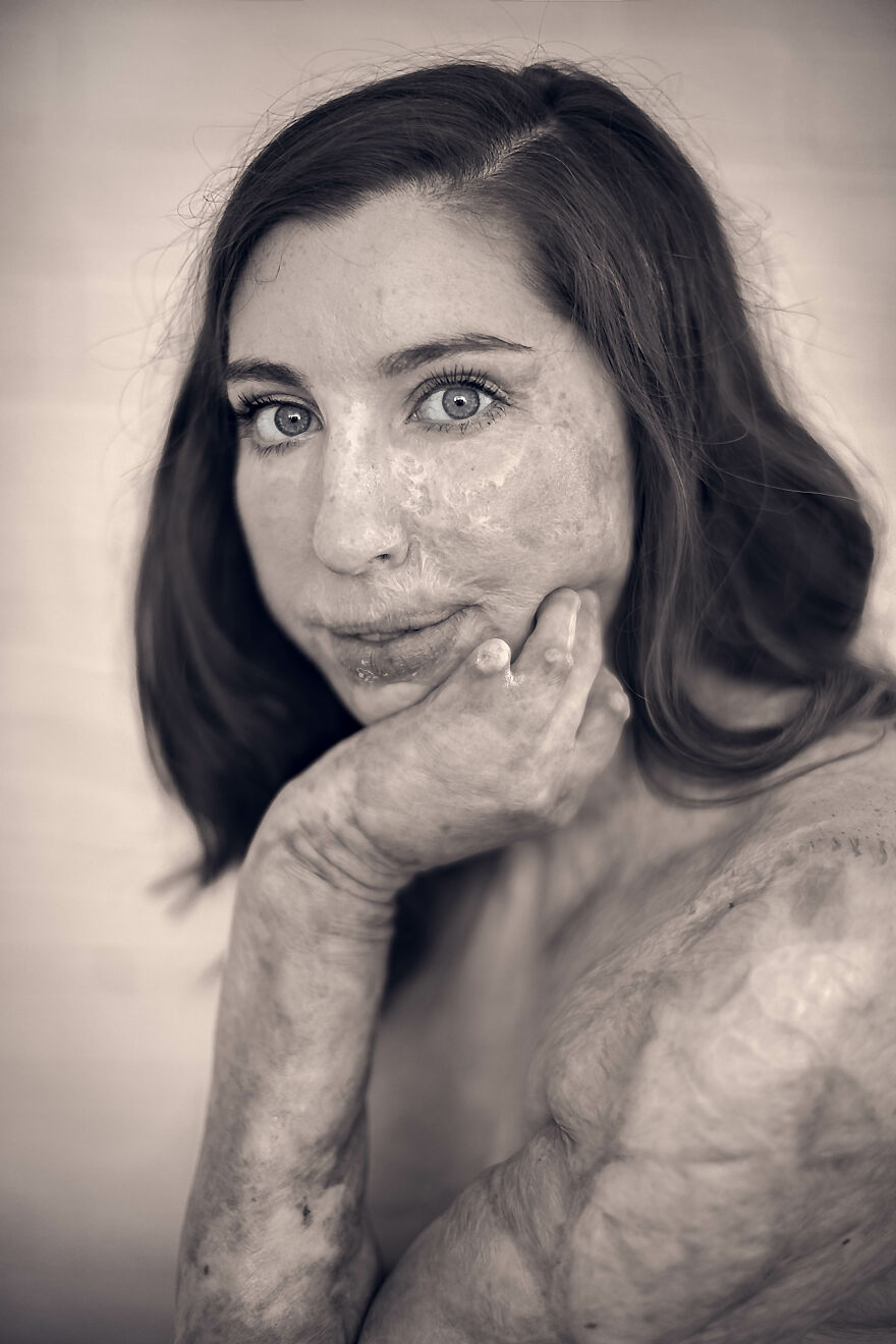 My 8-Year-Old Daughter Asked Me If She Was Beautiful, So I Decided To Do This Photo Project