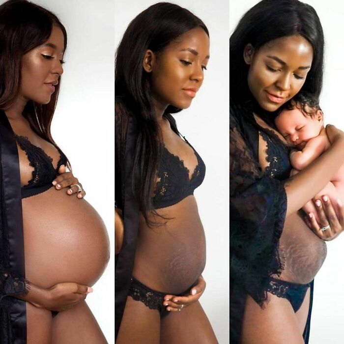 30 Honest Photos Of Post-Baby Bodies That Women Are Sharing To Reveal The Truth That Few People Talk About (New Pics) 30 Honest Photos Of Post-Baby Bodies That Women Are Sharing To Reveal The Truth That Few People Talk About (New Pics)