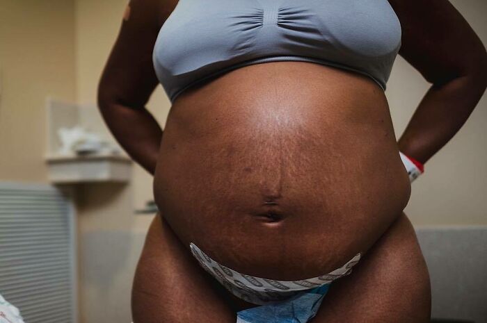 30 Honest Photos Of Post-Baby Bodies That Women Are Sharing To Reveal The Truth That Few People Talk About (New Pics) 30 Honest Photos Of Post-Baby Bodies That Women Are Sharing To Reveal The Truth That Few People Talk About (New Pics)