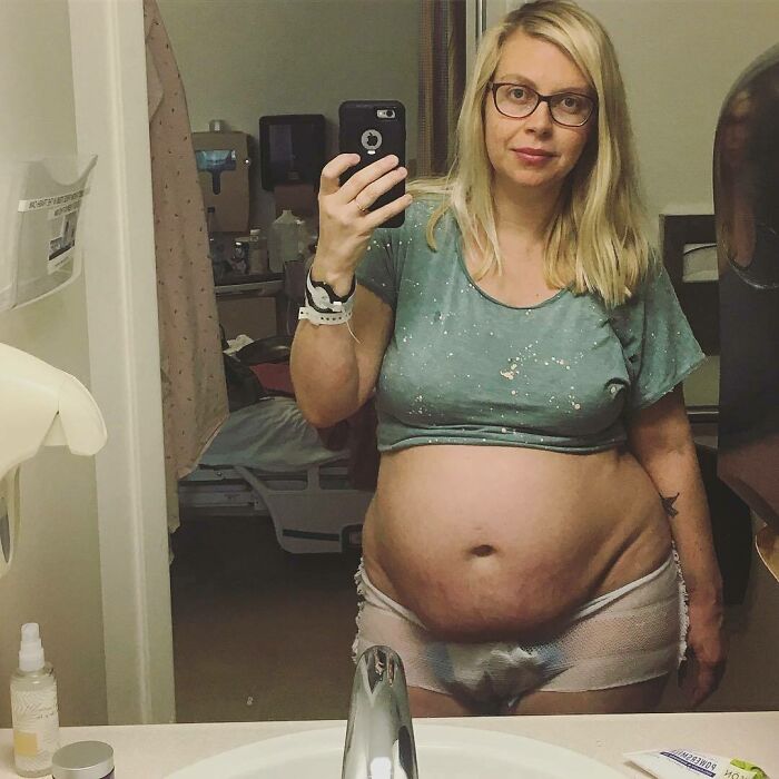 30 Honest Photos Of Post-Baby Bodies That Women Are Sharing To Reveal The Truth That Few People Talk About (New Pics) 30 Honest Photos Of Post-Baby Bodies That Women Are Sharing To Reveal The Truth That Few People Talk About (New Pics)