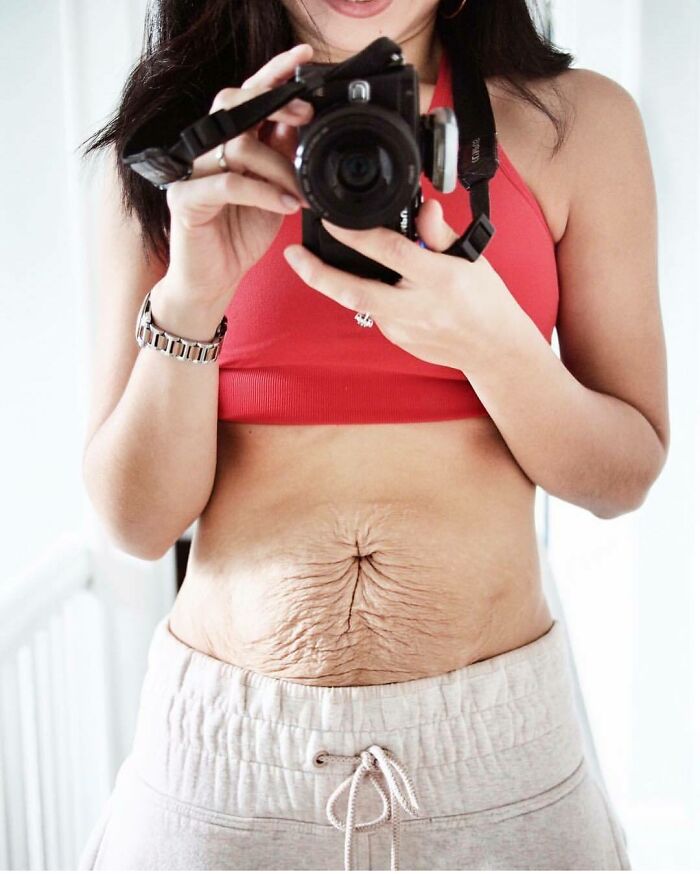 30 Honest Photos Of Post-Baby Bodies That Women Are Sharing To Reveal The Truth That Few People Talk About (New Pics) 30 Honest Photos Of Post-Baby Bodies That Women Are Sharing To Reveal The Truth That Few People Talk About (New Pics)
