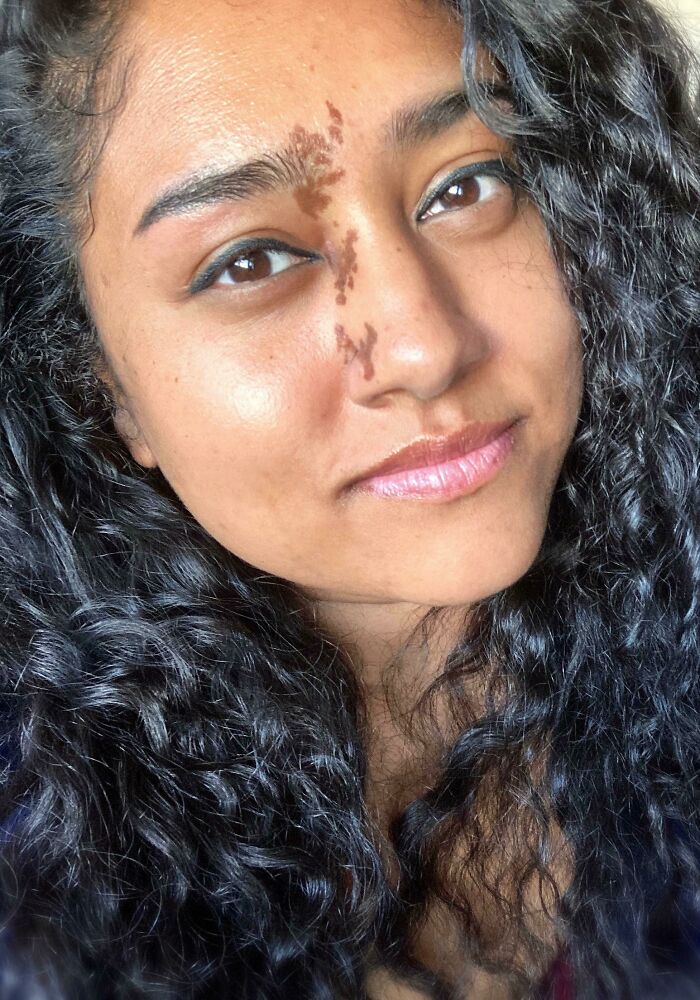 50 Photos Of Unique People’s Features Because Of Their Rare Genetics (New Pics) 50 Photos Of Unique People’s Features Because Of Their Rare Genetics (New Pics)