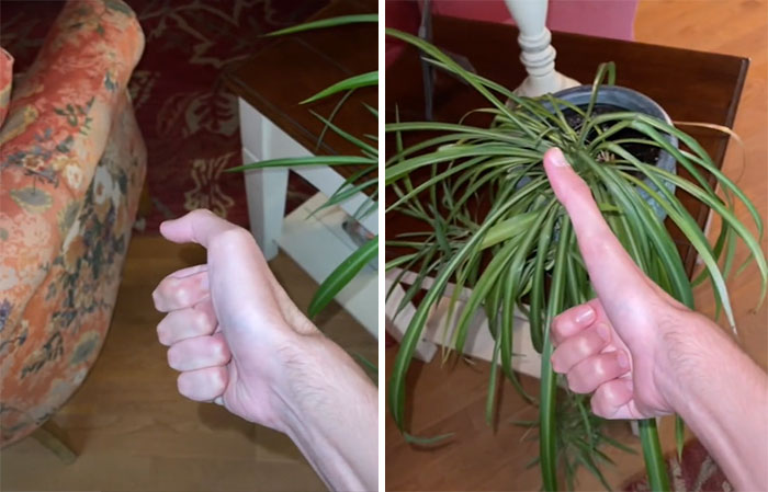 50 Photos Of Unique People’s Features Because Of Their Rare Genetics (New Pics) 50 Photos Of Unique People’s Features Because Of Their Rare Genetics (New Pics)