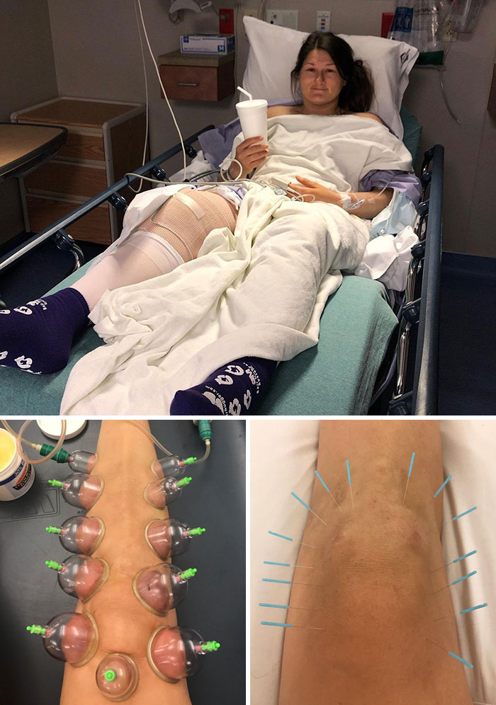 50 Freaky Photos Of Olympians And Other Athletes To Give You A New Perspective On The Human Body 50 Freaky Photos Of Olympians And Other Athletes To Give You A New Perspective On The Human Body