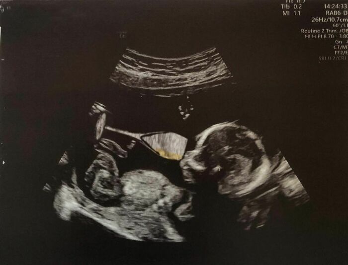 Dad Sends His GF These Pics Whenever She Asks If Their Babies Are OK While He’s Watching Them (30 New Pics) Dad Sends His GF These Pics Whenever She Asks If Their Babies Are OK While He’s Watching Them (30 New Pics)