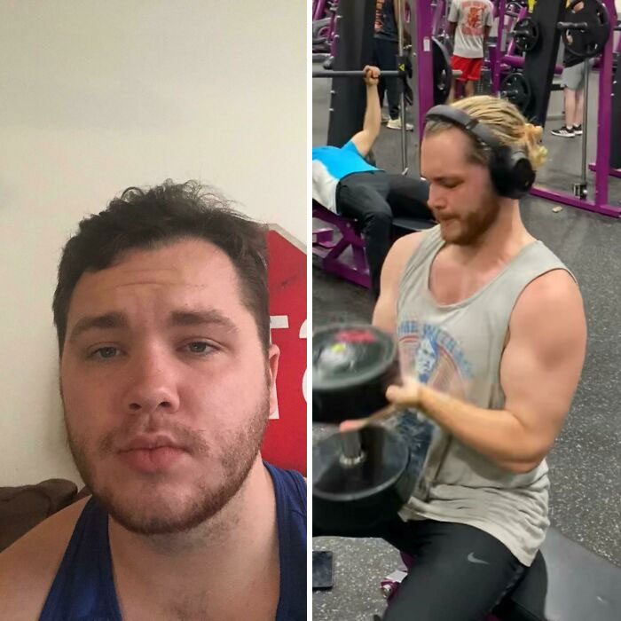 30 “Ugly Ducklings” Share Their Incredible Transformations Into Beautiful Swans (New Pics) 30 “Ugly Ducklings” Share Their Incredible Transformations Into Beautiful Swans (New Pics)