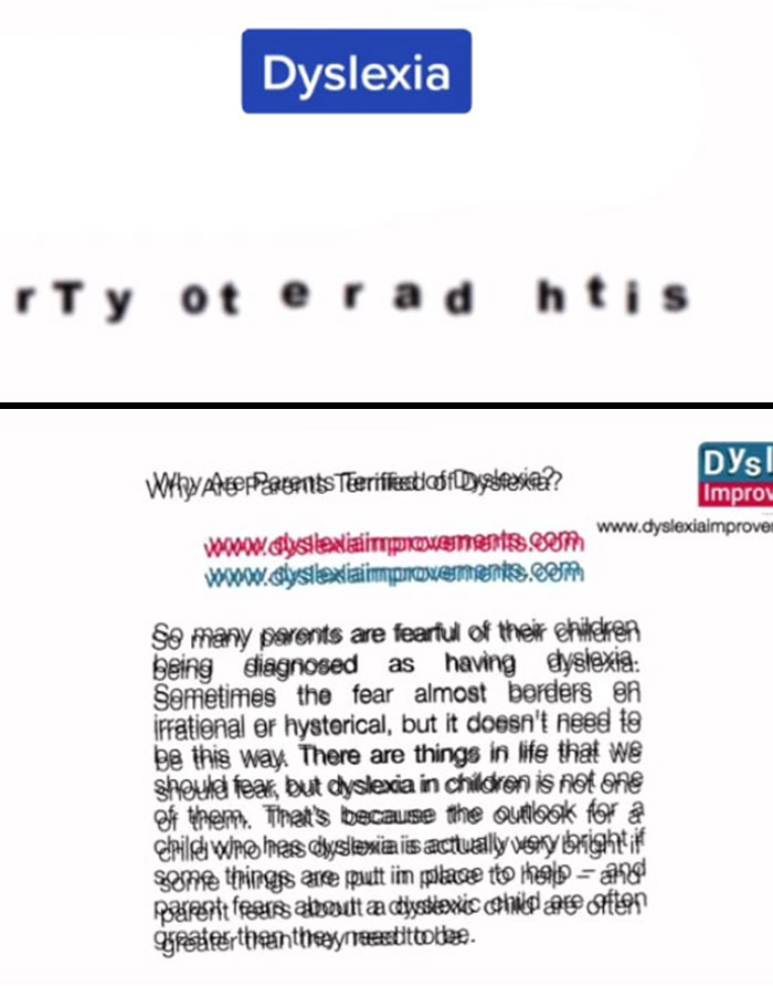 Medical Student Shows How People With Certain Medical Conditions See (19 Pics) Medical Student Shows How People With Certain Medical Conditions See (19 Pics)