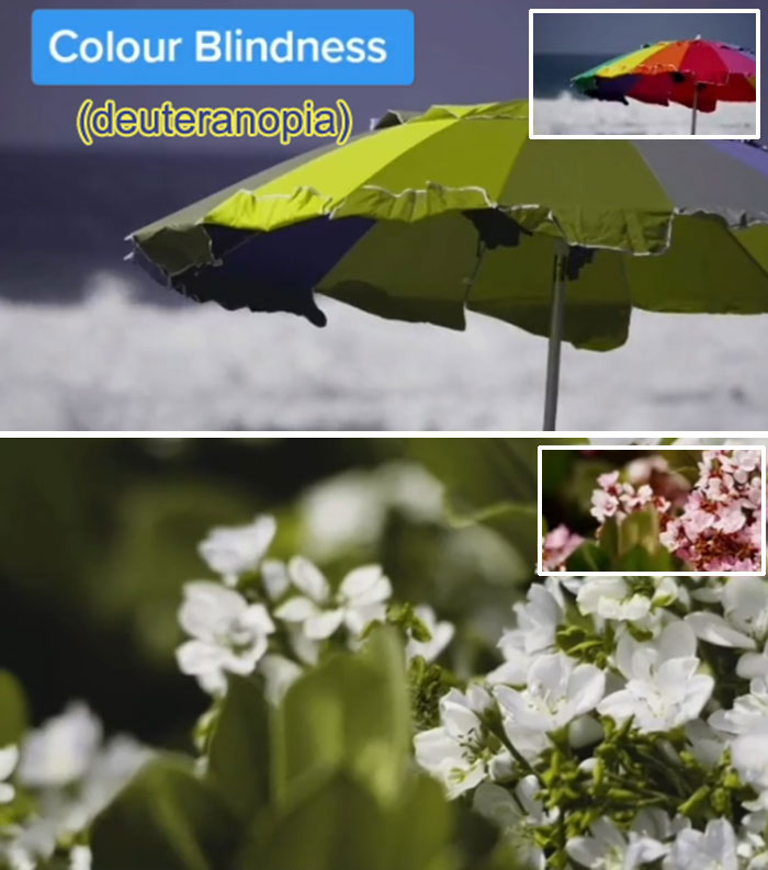 Medical Student Shows How People With Certain Medical Conditions See (19 Pics) Medical Student Shows How People With Certain Medical Conditions See (19 Pics)