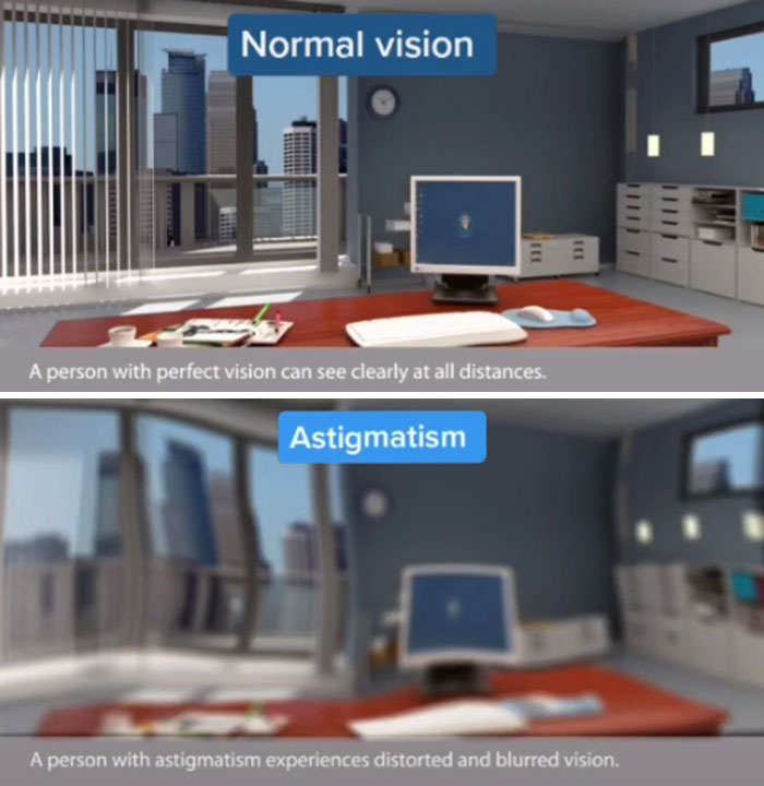 Medical Student Shows How People With Certain Medical Conditions See (19 Pics) Medical Student Shows How People With Certain Medical Conditions See (19 Pics)