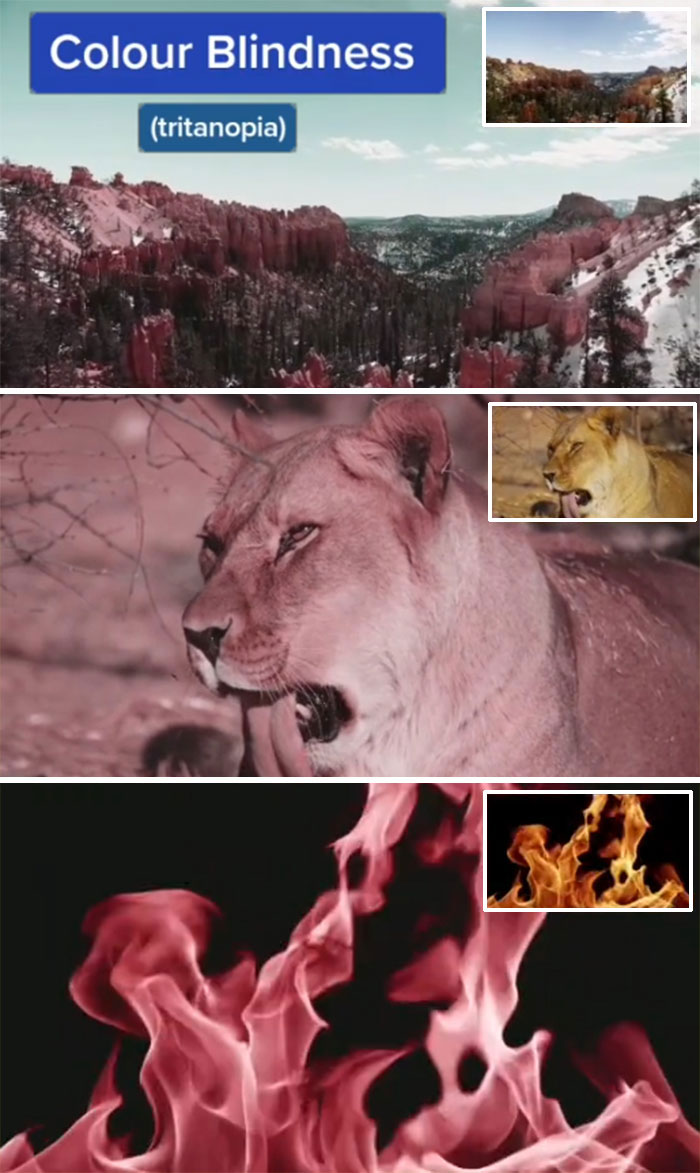 Medical Student Shows How People With Certain Medical Conditions See (19 Pics) Medical Student Shows How People With Certain Medical Conditions See (19 Pics)