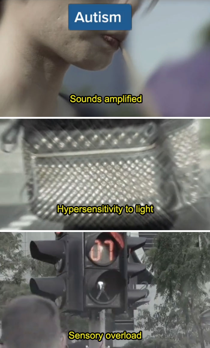 Medical Student Shows How People With Certain Medical Conditions See (19 Pics) Medical Student Shows How People With Certain Medical Conditions See (19 Pics)