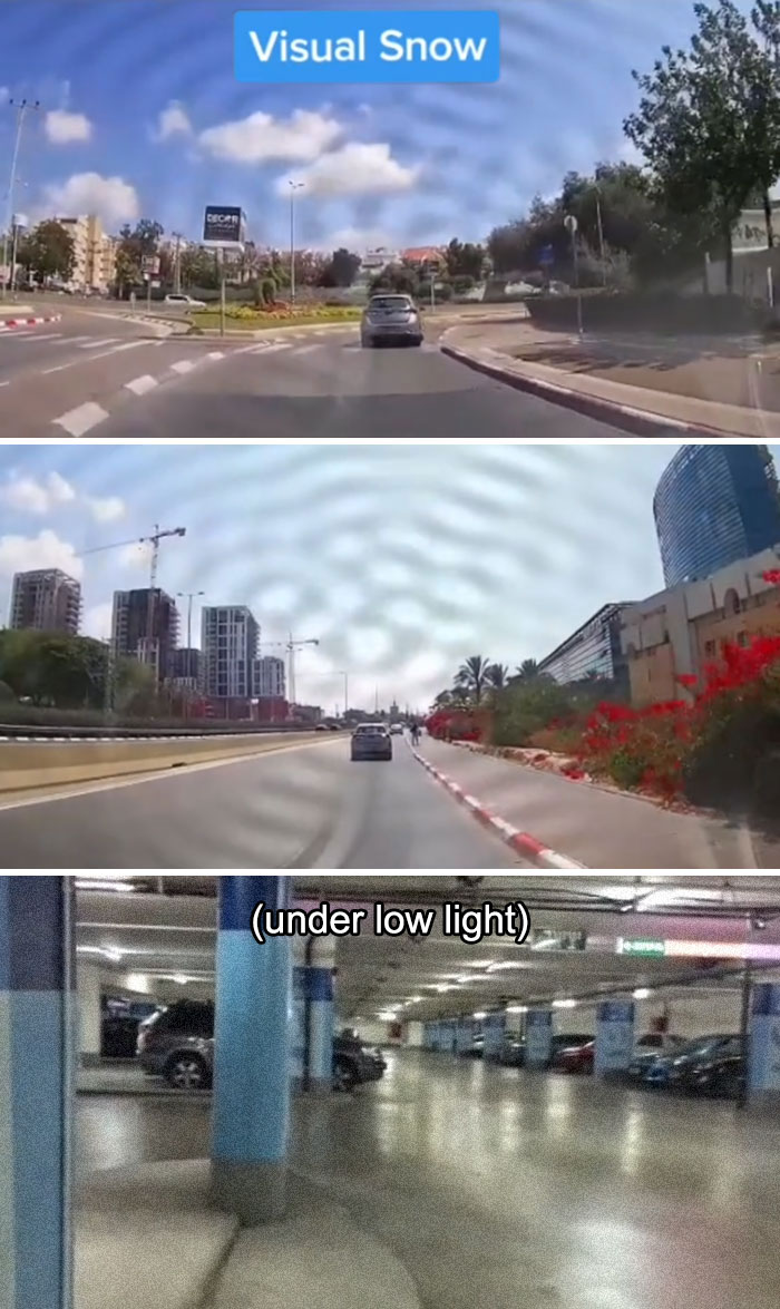 Medical Student Shows How People With Certain Medical Conditions See (19 Pics) Medical Student Shows How People With Certain Medical Conditions See (19 Pics)