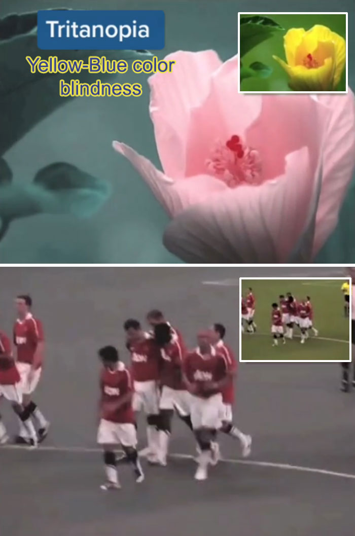 Medical Student Shows How People With Certain Medical Conditions See (19 Pics) Medical Student Shows How People With Certain Medical Conditions See (19 Pics)