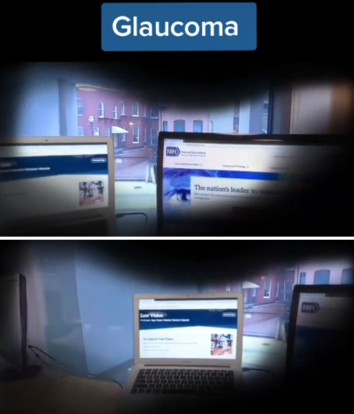 Medical Student Shows How People With Certain Medical Conditions See (19 Pics) Medical Student Shows How People With Certain Medical Conditions See (19 Pics)