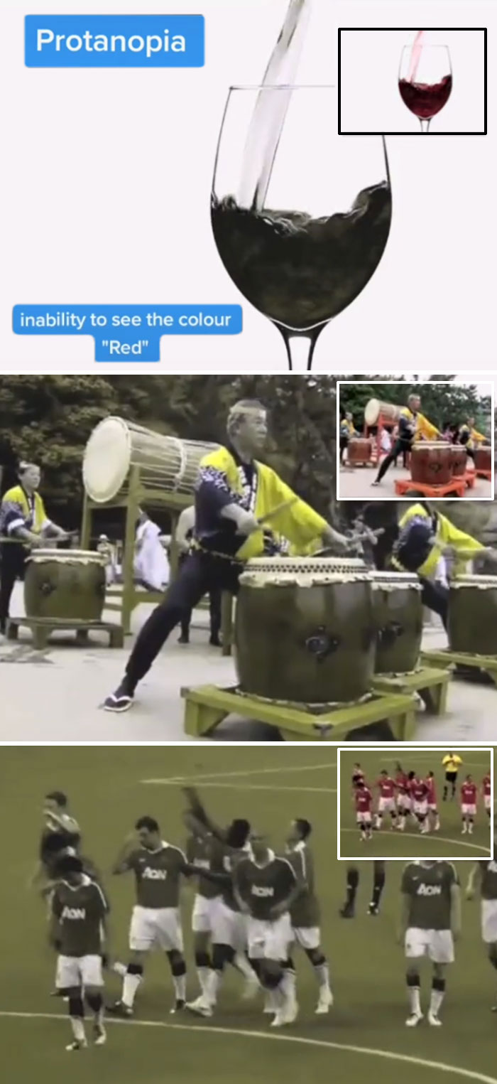 Medical Student Shows How People With Certain Medical Conditions See (19 Pics) Medical Student Shows How People With Certain Medical Conditions See (19 Pics)