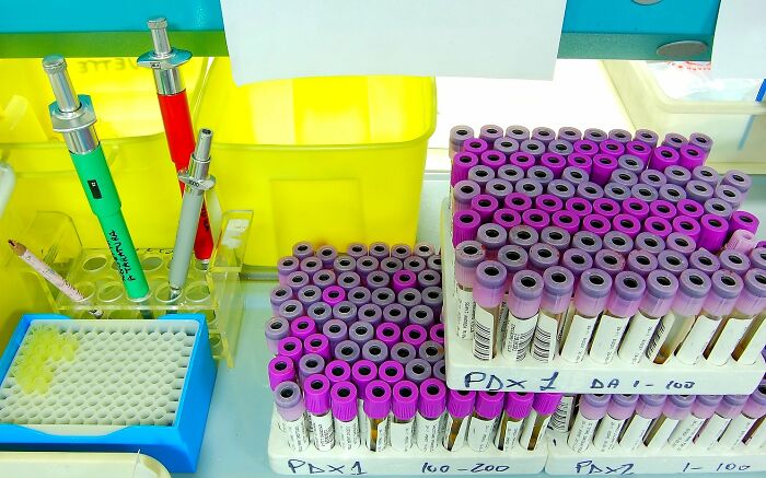 30 People In This Online Group Share Unexpected Features That Make Them 1% Of The Population 30 People In This Online Group Share Unexpected Features That Make Them 1% Of The Population