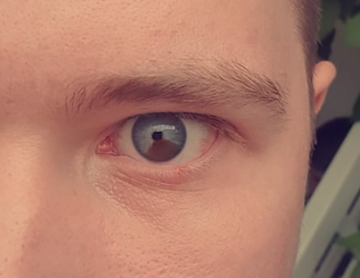 30 People In This Online Group Share Unexpected Features That Make Them 1% Of The Population 30 People In This Online Group Share Unexpected Features That Make Them 1% Of The Population