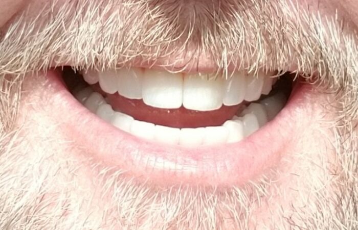 30 People In This Online Group Share Unexpected Features That Make Them 1% Of The Population 30 People In This Online Group Share Unexpected Features That Make Them 1% Of The Population