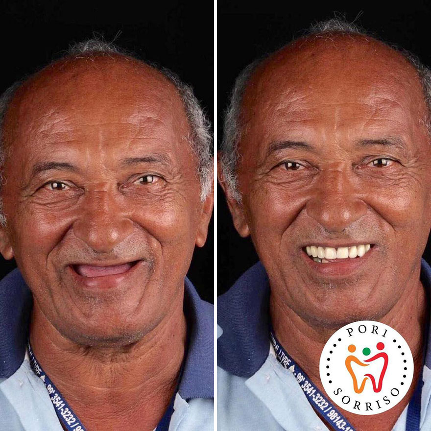 Brazilian Dentist Travels To Treat The Teeth Of Poor People For Free And Here Are 30 Transformations Brazilian Dentist Travels To Treat The Teeth Of Poor People For Free And Here Are 30 Transformations