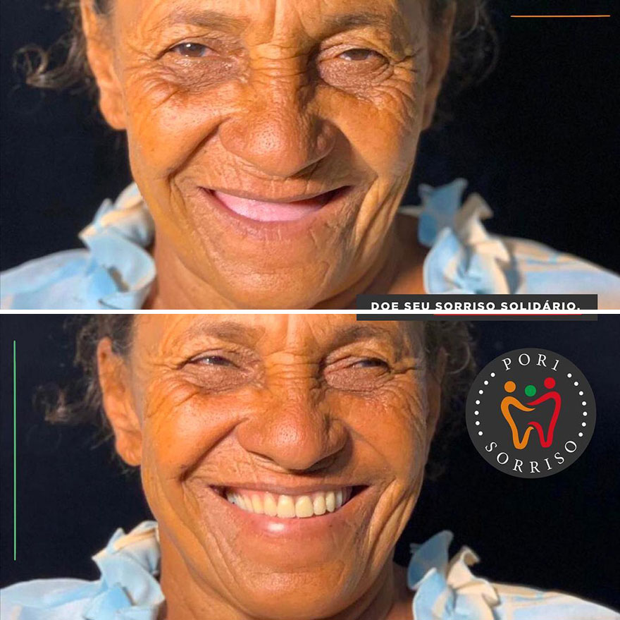Brazilian Dentist Travels To Treat The Teeth Of Poor People For Free And Here Are 30 Transformations Brazilian Dentist Travels To Treat The Teeth Of Poor People For Free And Here Are 30 Transformations