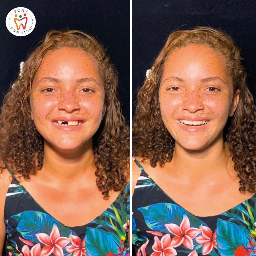 Brazilian Dentist Travels To Treat The Teeth Of Poor People For Free And Here Are 30 Transformations Brazilian Dentist Travels To Treat The Teeth Of Poor People For Free And Here Are 30 Transformations