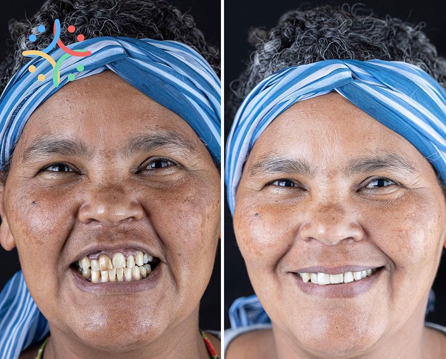 Brazilian Dentist Travels To Treat The Teeth Of Poor People For Free And Here Are 30 Transformations Brazilian Dentist Travels To Treat The Teeth Of Poor People For Free And Here Are 30 Transformations