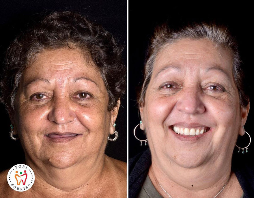 Brazilian Dentist Travels To Treat The Teeth Of Poor People For Free And Here Are 30 Transformations Brazilian Dentist Travels To Treat The Teeth Of Poor People For Free And Here Are 30 Transformations