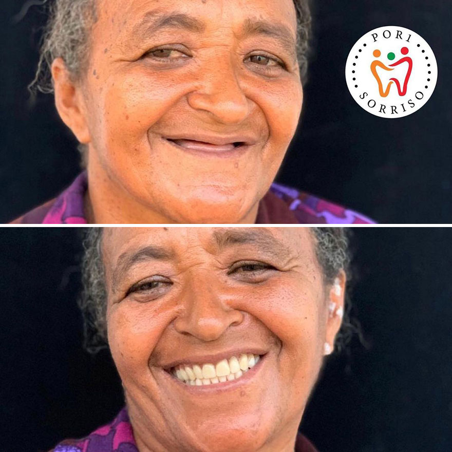 Brazilian Dentist Travels To Treat The Teeth Of Poor People For Free And Here Are 30 Transformations Brazilian Dentist Travels To Treat The Teeth Of Poor People For Free And Here Are 30 Transformations