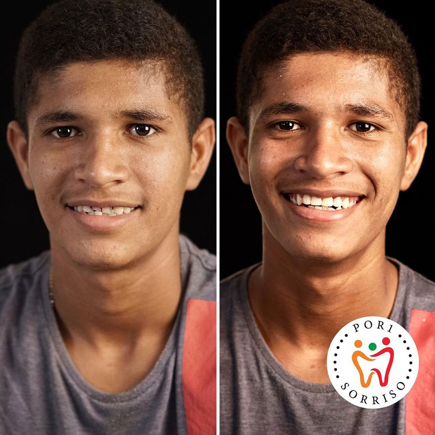 Brazilian Dentist Travels To Treat The Teeth Of Poor People For Free And Here Are 30 Transformations Brazilian Dentist Travels To Treat The Teeth Of Poor People For Free And Here Are 30 Transformations