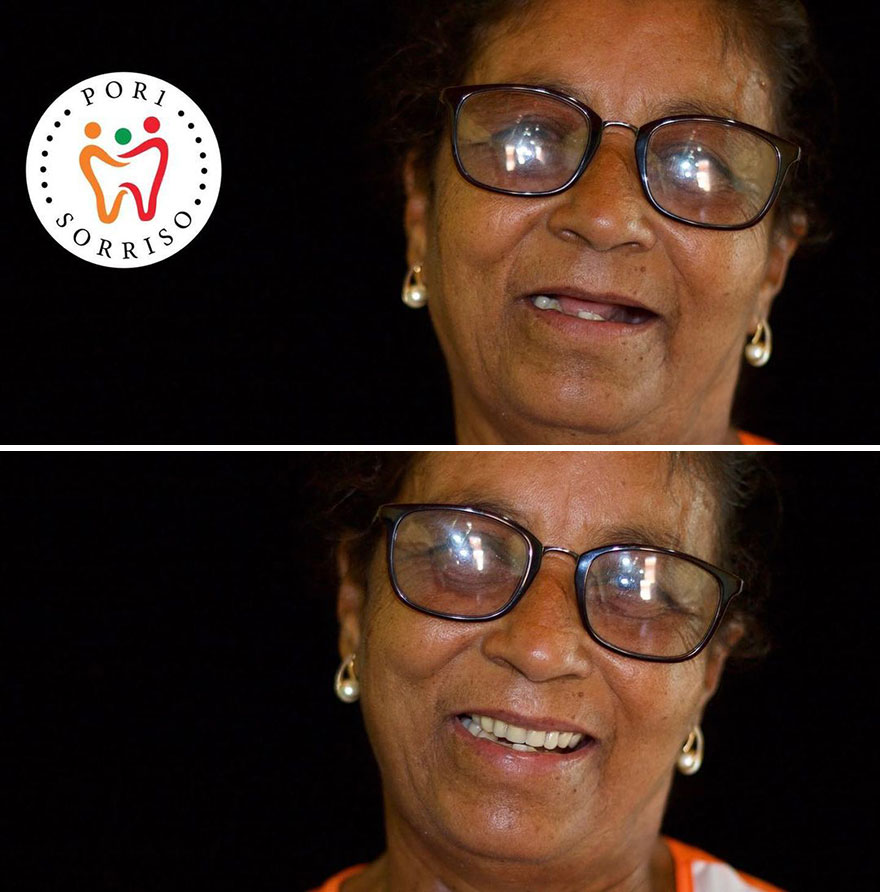 Brazilian Dentist Travels To Treat The Teeth Of Poor People For Free And Here Are 30 Transformations Brazilian Dentist Travels To Treat The Teeth Of Poor People For Free And Here Are 30 Transformations